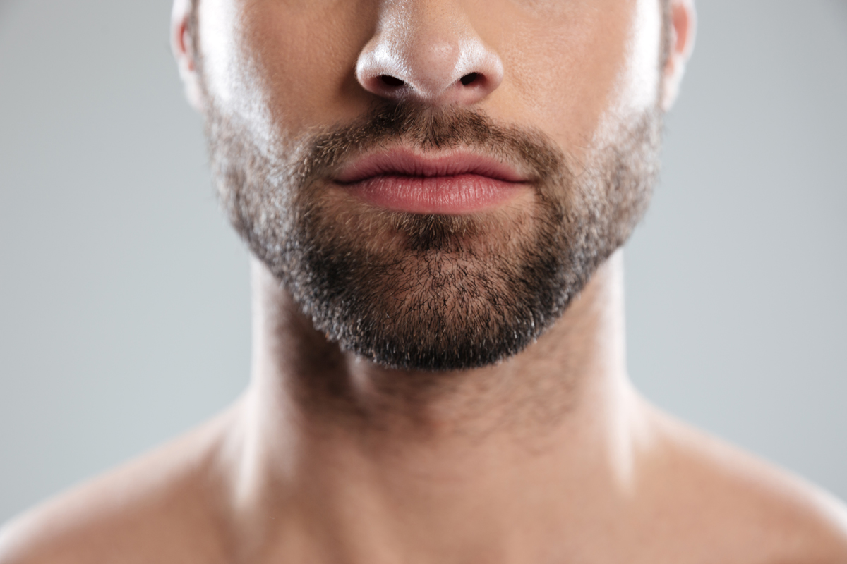 trapianto barba baffi e basette