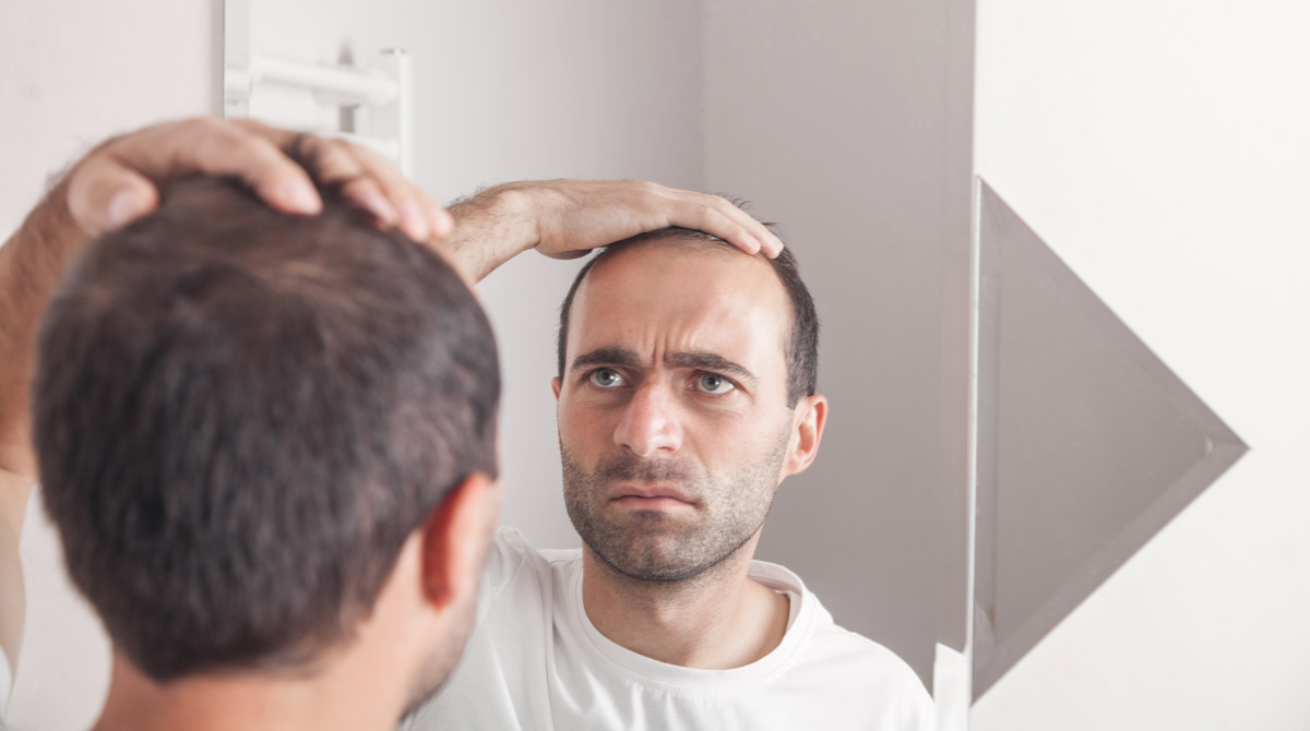 trapianto di capelli andato male