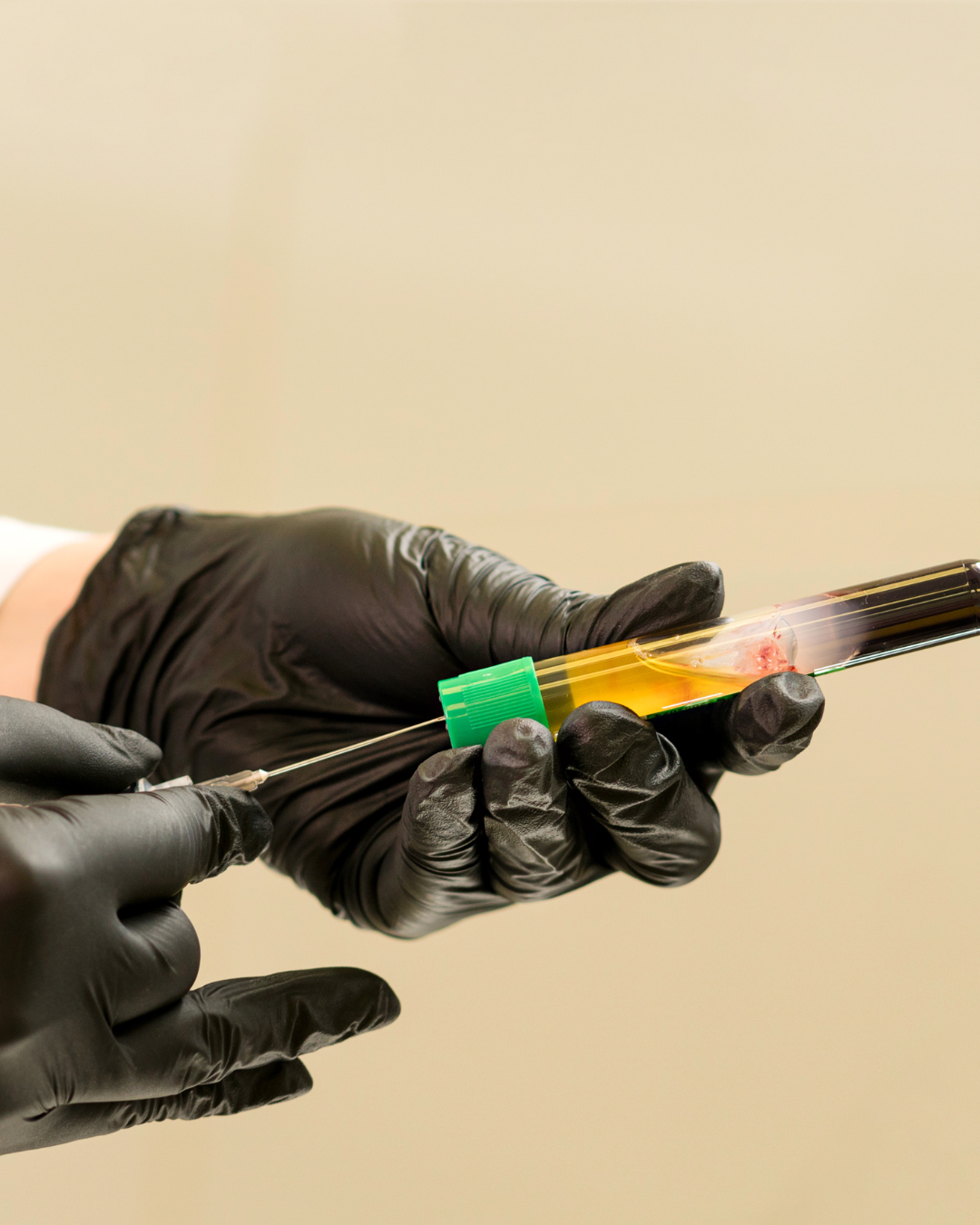 fiala contenente plasma