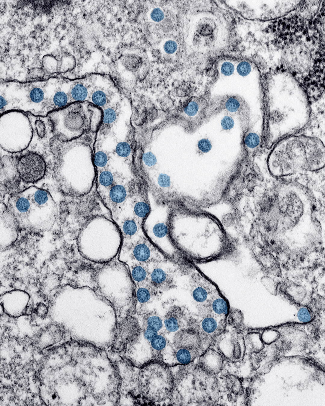 microbioma al microscopio