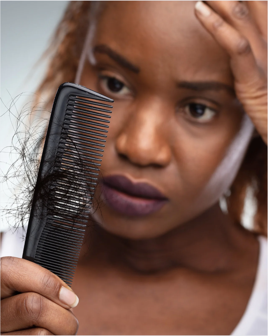 persona che si tiene un pettine in mano pieno di capelli